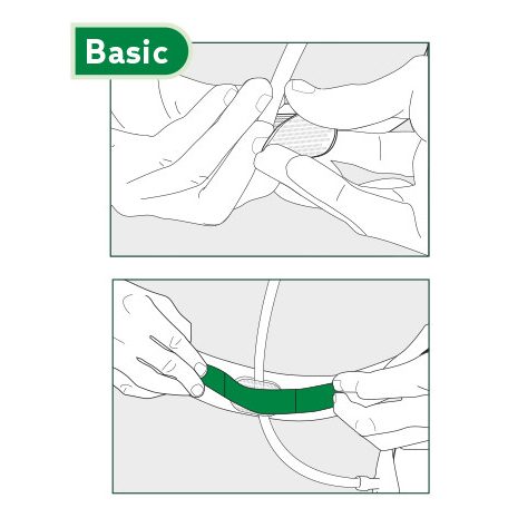 Sauer NephSys öv - BASIC